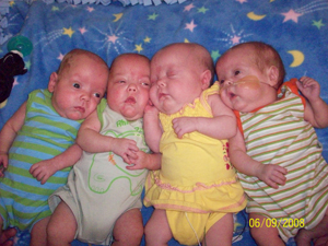 Quadruplets Babies