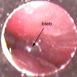 Unit Four Middle Ear Disease Diagnosis